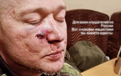 Лідер гурту «Бумбокс» Андрій Хливнюк отримав поранення - vogue.ua