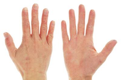 Как лечить трещины на пальцах рук? - shkolazhizni.ru