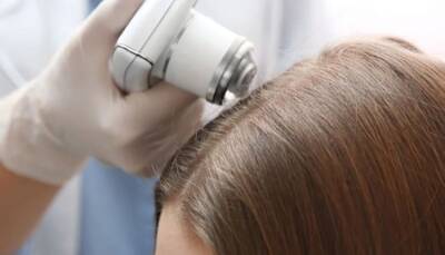 Что делать при выпадении волос, советует врач-трихолог Валентина Приймак - fokus-vnimaniya.com