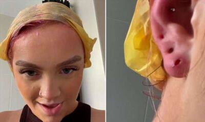Женщина потеряла часть уха из-за дешевых сережек - chert-poberi.ru