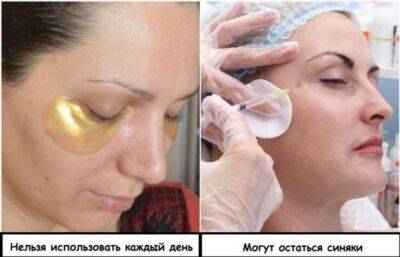 5 популярных бьюти-процедур, которые не убирают морщины, а приближают старость - milayaya.ru
