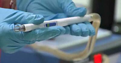 Хірургічний ніж iKnife за декілька секунд виявляє рак шийки матки - womo.ua - місто Лондон