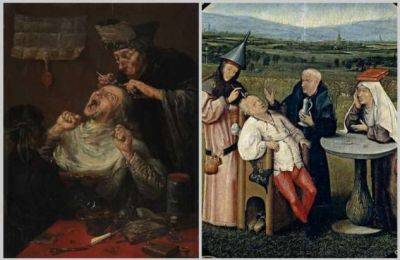 Почему в Средневековье рисовали врачей, которые разрезают голову пациенту наживую - chert-poberi.ru