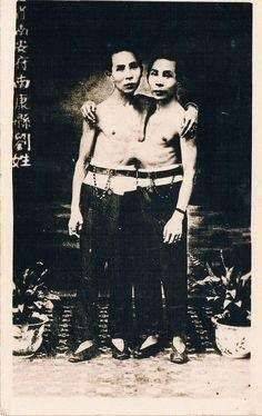 Вы точно знаете про братьев Чанг и Энг Банкер - chert-poberi.ru - Сша - Таиланд