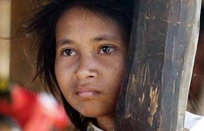 Печальная история камбоджийской девушки-обезьянки (7 фото) - porosenka.net