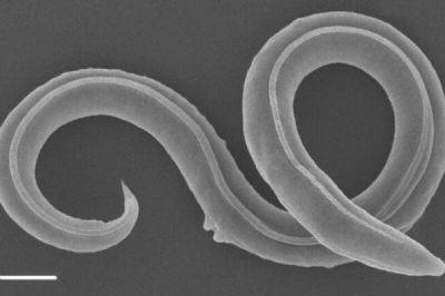Российские учёные оживили неизвестный вид червя возрастом 46 тысяч лет - porosenka.net