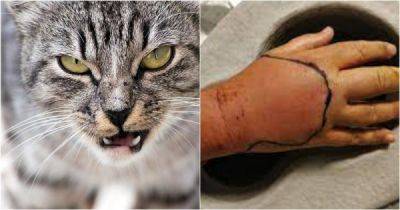 Кот укусил жителя Великобритании и он заразился неизвестной инфекцией - porosenka.net - Англия