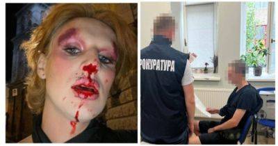Побиття трансгендерної військової у Льовові: поліція затримала нападника, фото - womo.ua