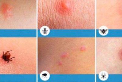 ВАЖНО! 8 типов укусов насекомых, о которых вы просто обязаны знать! - lublusebya.ru