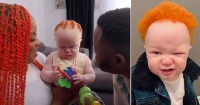 У чернокожих родителей получился ребёнок-альбинос с рыжими волосами - porosenka.net