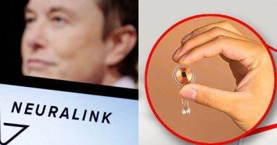 Илона Маска - Стивен Хокинг - Компания Илона Маска впервые вживила имплант в мозг человека - porosenka.net