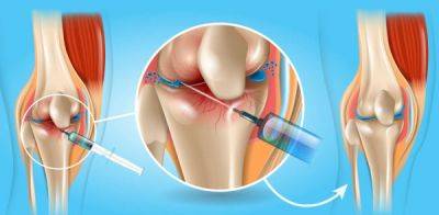 Операция по замене сустава или инъекции? Что эффективнее при лечении коленей - ФОКУС ВНИМАНИЯ - fokus-vnimaniya.com