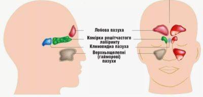 Клинические рекомендации при остром синусите - jlady.ru